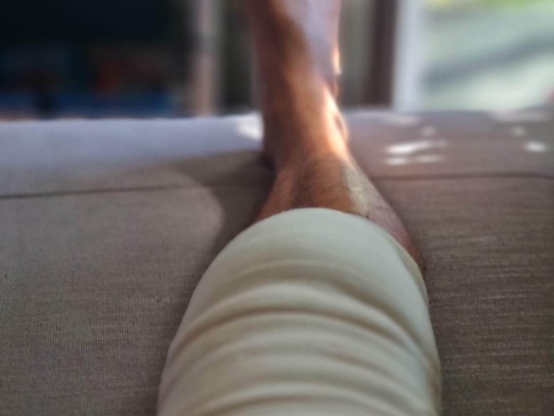 Drenaż limfatyczny BOA w Będzinie